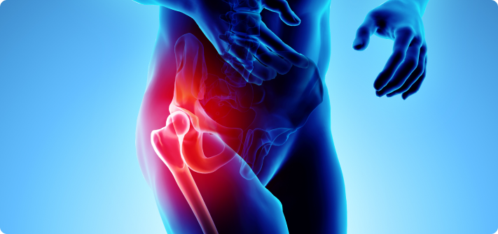 Signs and Symptoms of a Hip Labral Tear
