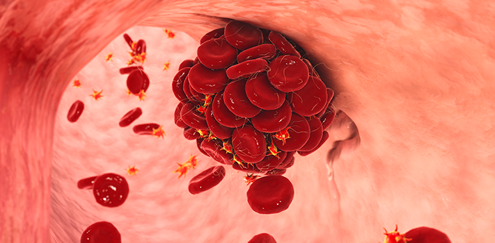 Risks of Sports Surgery