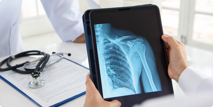 Shoulder Treatments We Provide