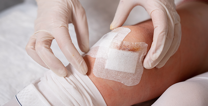 How Is Knee Arthroscopy Performed?