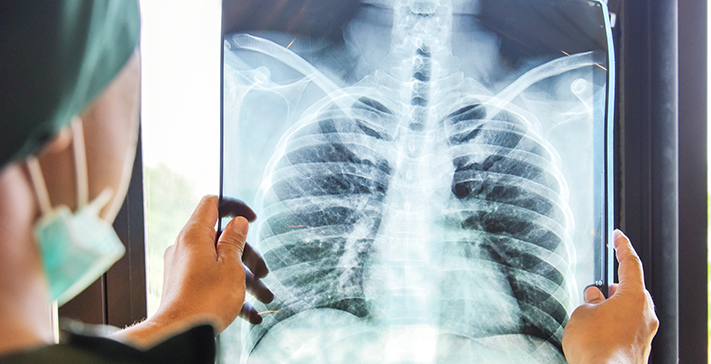 Risks of Frozen Shoulder Surgery