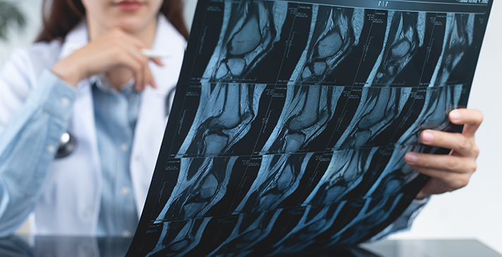 What Can Knee Arthroscopy Diagnose?