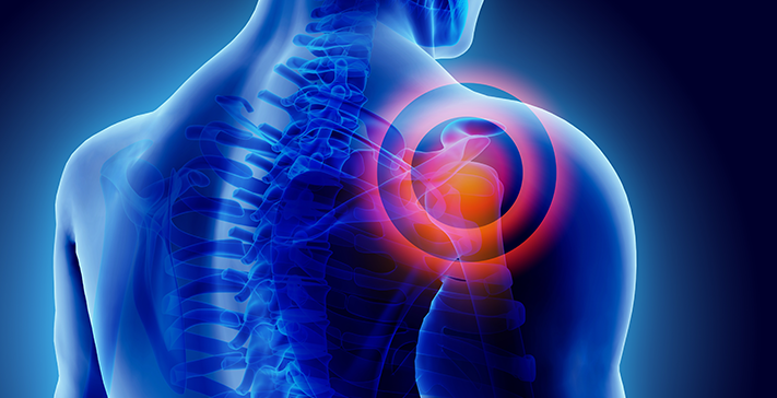 What Can Shoulder Arthroscopy Diagnose?