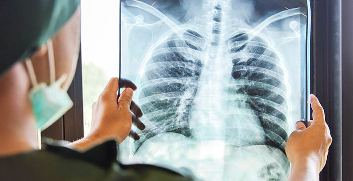 Who is a Suitable Candidate for Arthroscopy?