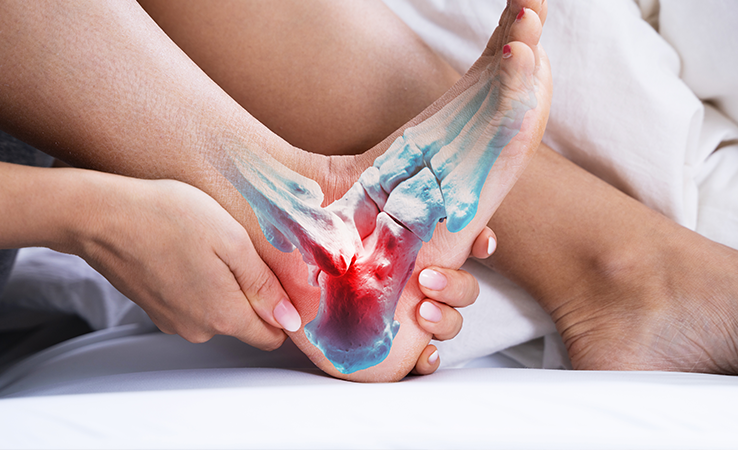 Can an Achilles Tendonitis Be Prevented?