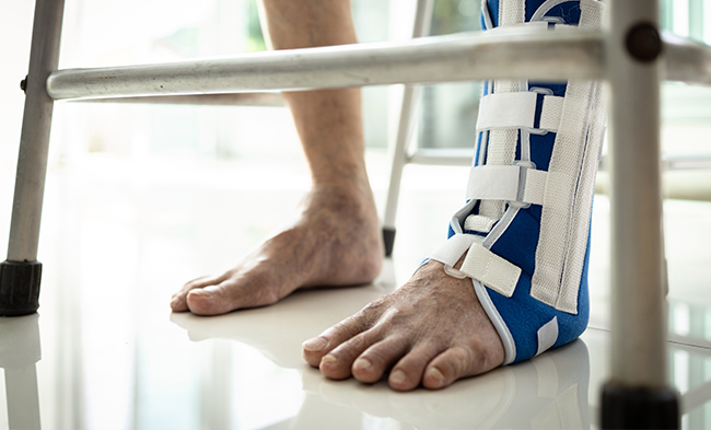 Can an Ankle Fracture Be Prevented?