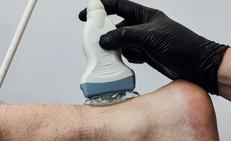 Achilles Tendonitis Treatment