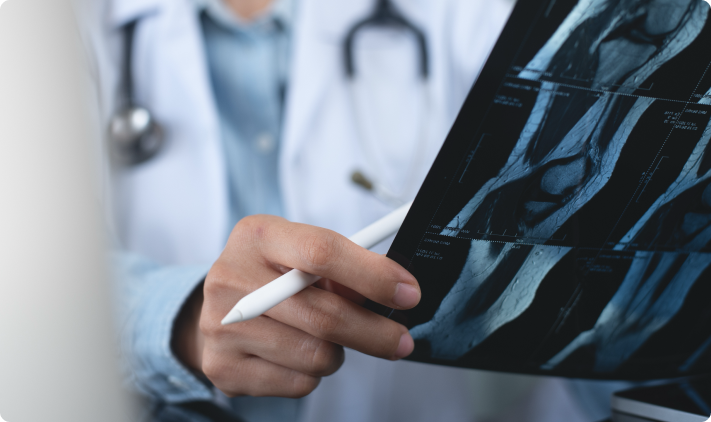 How is ACL Reconstruction Performed?