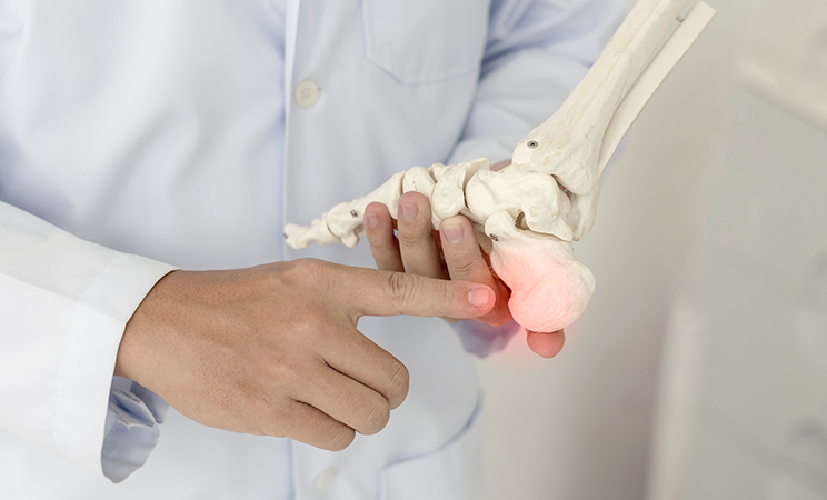 How Is an Plantar Fasciitis Diagnosed?