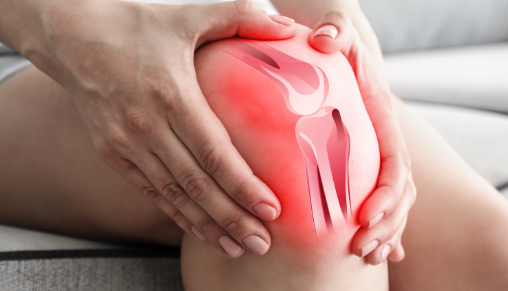 Signs and Symptoms of an ACL Injury