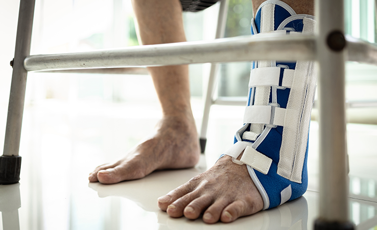 Risk Factors of Achilles Tendonitis