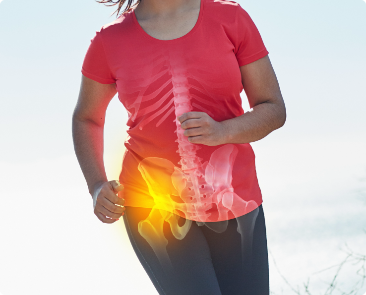 What Causes Hip Bursitis?