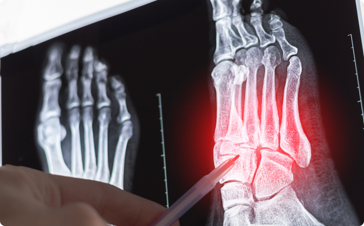 How Are Sports Injuries Diagnosed?