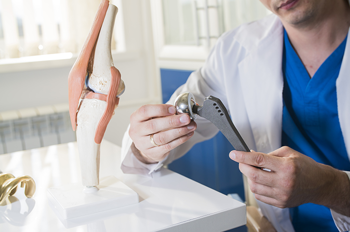 FAQs About Hip Replacement Surgery