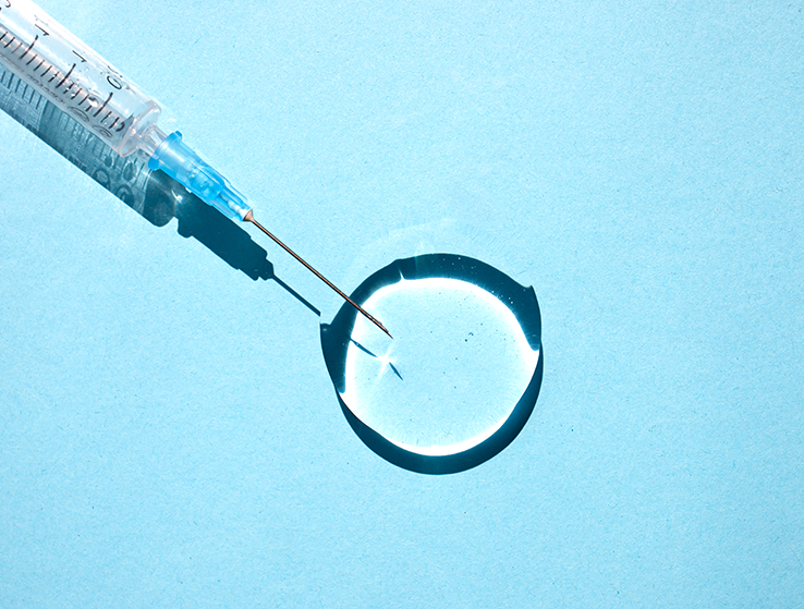 What is the Process for Hyaluronic Acid Injections?