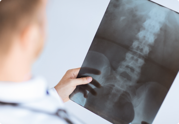 FAQs on Knee Pain & Treatments