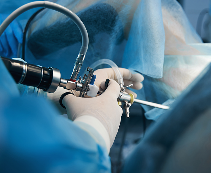 How is Keyhole (Laparoscopic) Meniscus Surgery Performed?