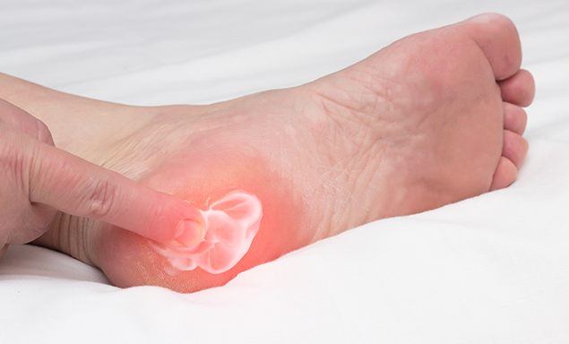 What Is an Plantar Fasciitis?