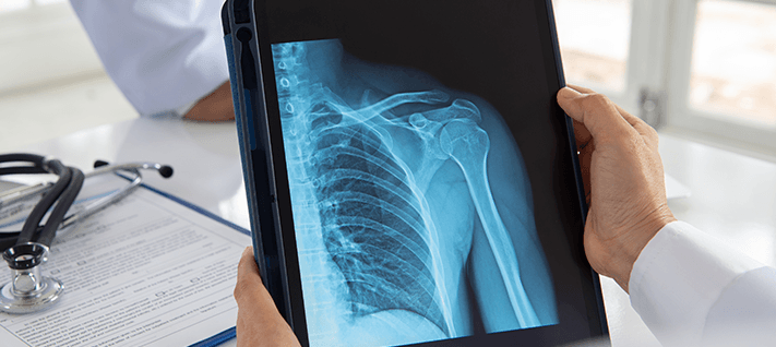 Shoulder Surgery