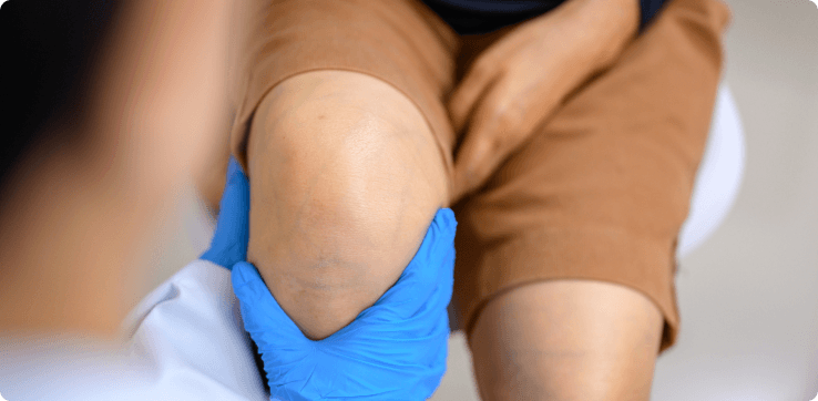 How is a Meniscus Tear Diagnosed?