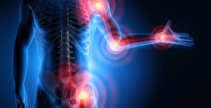 What Can Arthroscopy Diagnose?