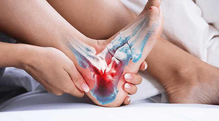 Can an Achilles Tendonitis Be Prevented?