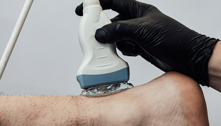 Achilles Tendonitis Treatment