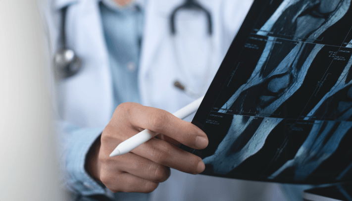 How Is an ACL Injury Diagnosed?