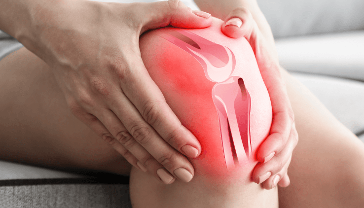Signs and Symptoms of an ACL Injury