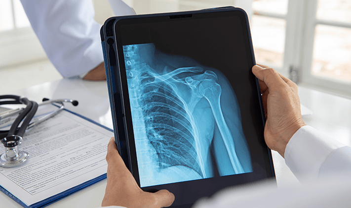 Shoulder Surgery