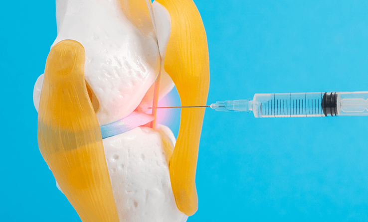 Sport Injuries Faqs