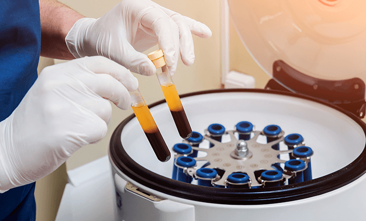 Platelet-Rich Plasma Faqs