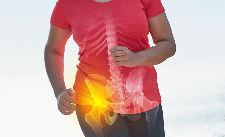 What Causes Hip Bursitis?