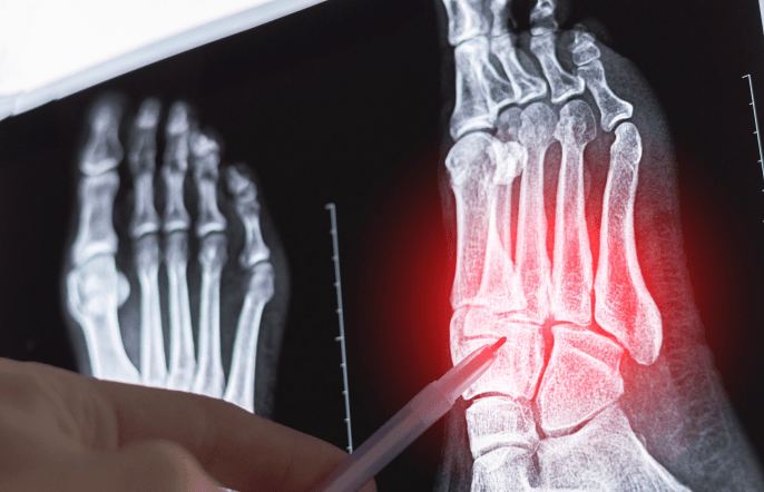  How Are Sports Injuries Diagnosed?