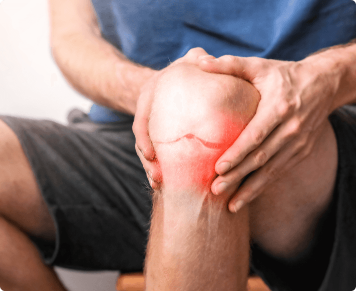 What Causes Knee Arthritis?