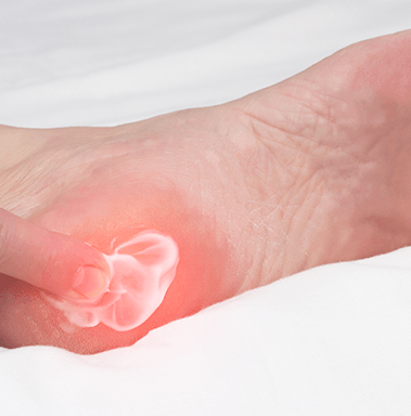 What Is an Plantar Fasciitis?