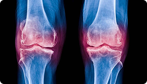 Causes of Knee Pain & How to Treat Them