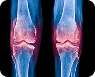 Causes of Knee Pain & How to Treat Them