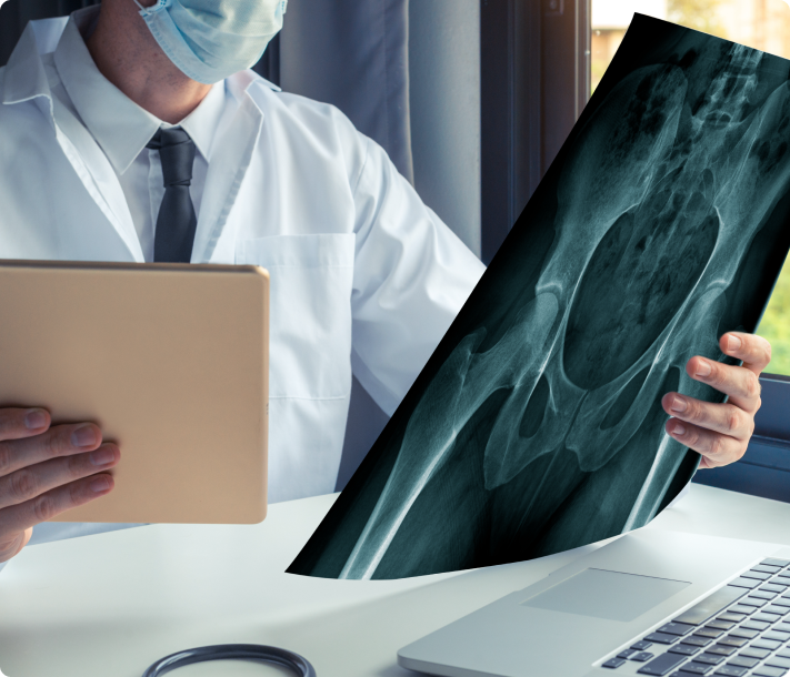 How is Hip Bursitis Diagnosed?