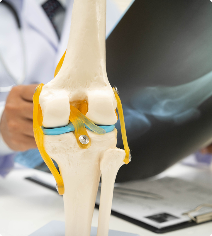 How Doctors Choose The Right Knee Replacement Implant
