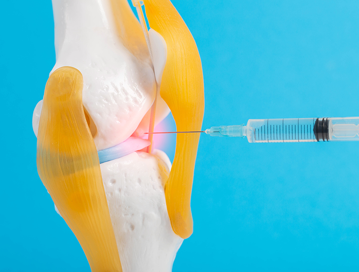 Sport Injuries Faqs