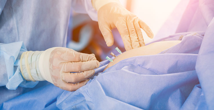 Surgery on patient