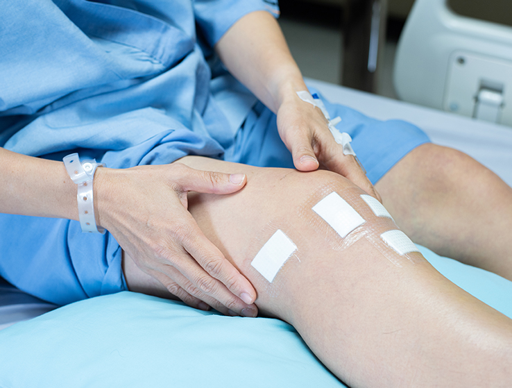 Patient lying on bed before PCL knee surgery