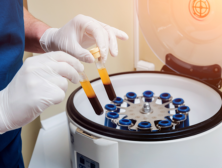 Platelet-Rich Plasma Faqs