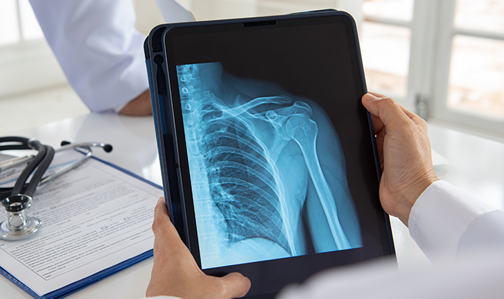 Shoulder Surgery
