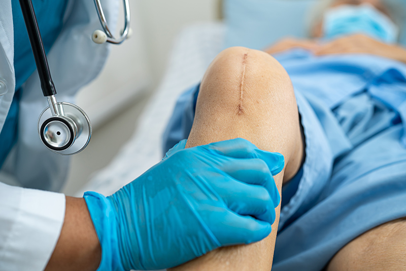 A woman going for a post-op check-up after her knee replacement surgery