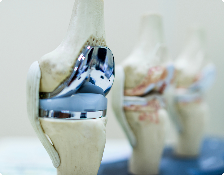 What Are The Different Types Of Knee Replacement Surgery Available?