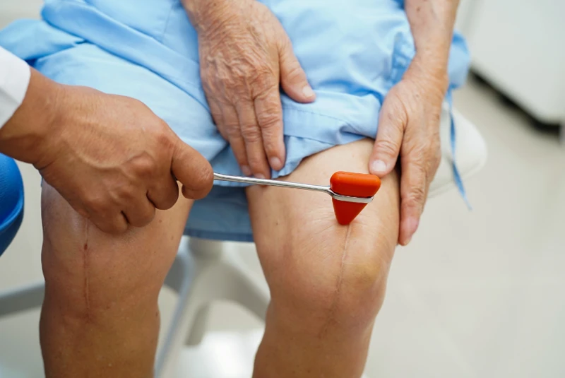 Patient getting their reflexes tested after knee replacement surgery.